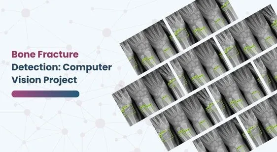 Bone Fracture Detection Computer Vision Project (1)