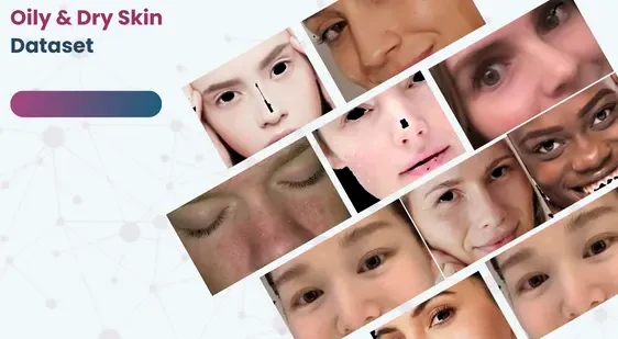 Oily & Dry Skin Dataset (ROI)