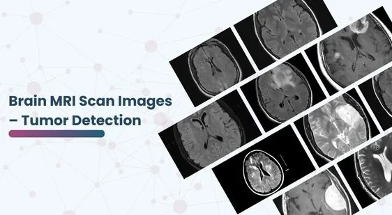 Brain MRI Scan Images – Tumor Detection