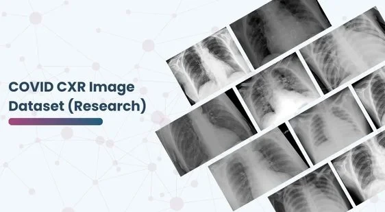 COVID CXR Image Dataset (Research)