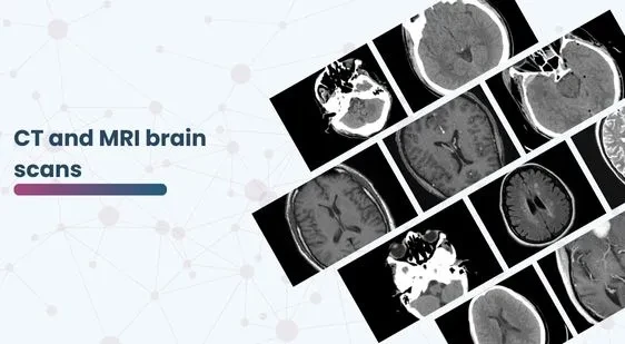 CT and MRI brain scans