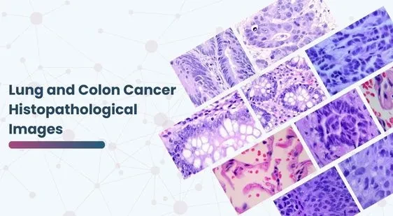 Lung and Colon Cancer Histopathological Images