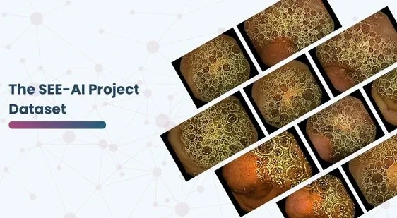 The SEE-AI Project Dataset