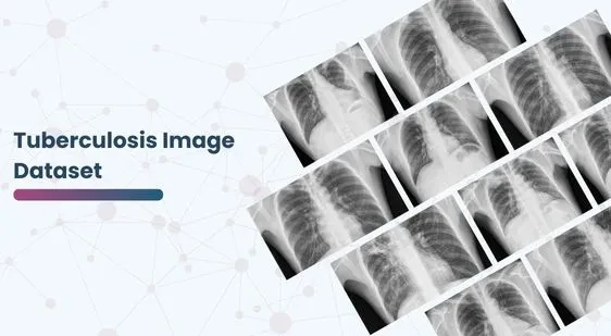 Tuberculosis Image Dataset