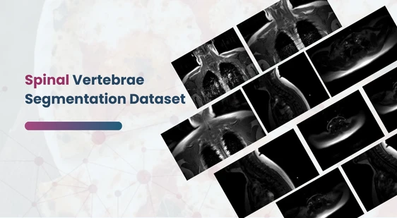 Spinal Vertebrae Segmentation Dataset