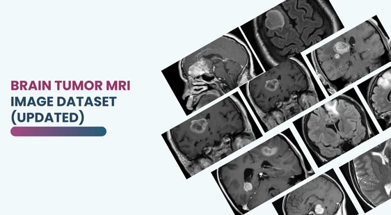 Brain Tumor MRI Image Dataset (Updated)