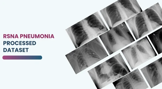 RSNA Pneumonia Processed Dataset